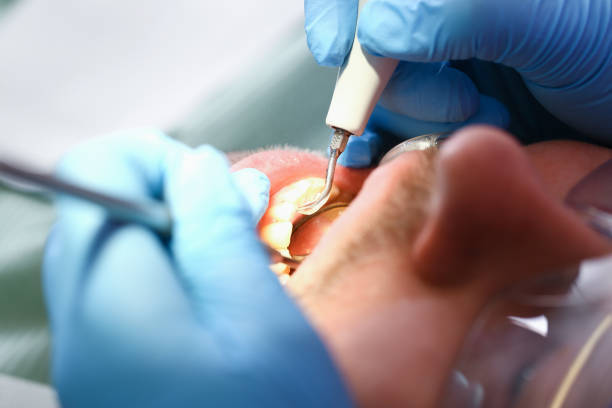 Best Emergency Root Canal Therapy in Diboll, TX